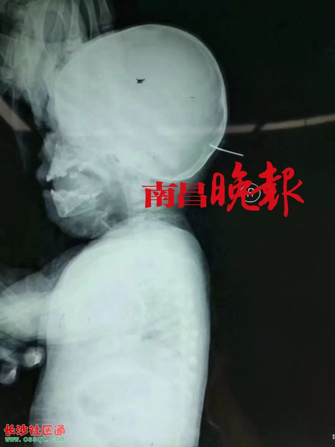 ΢ܛź